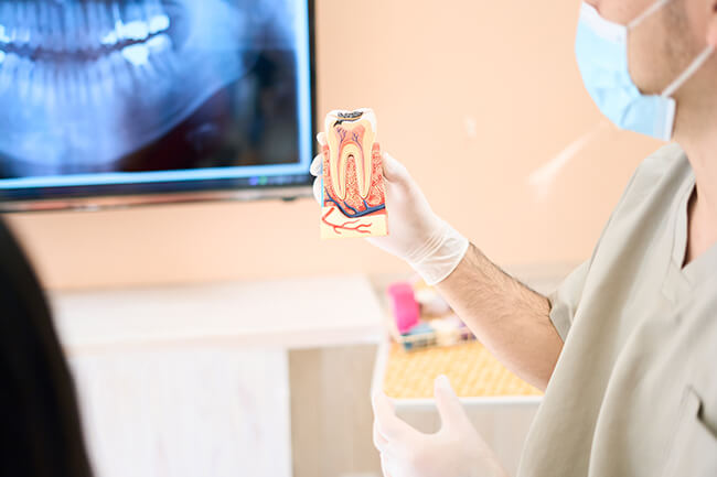 歯の移植・再植