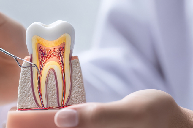 歯を残す治療（精密根管治療）
